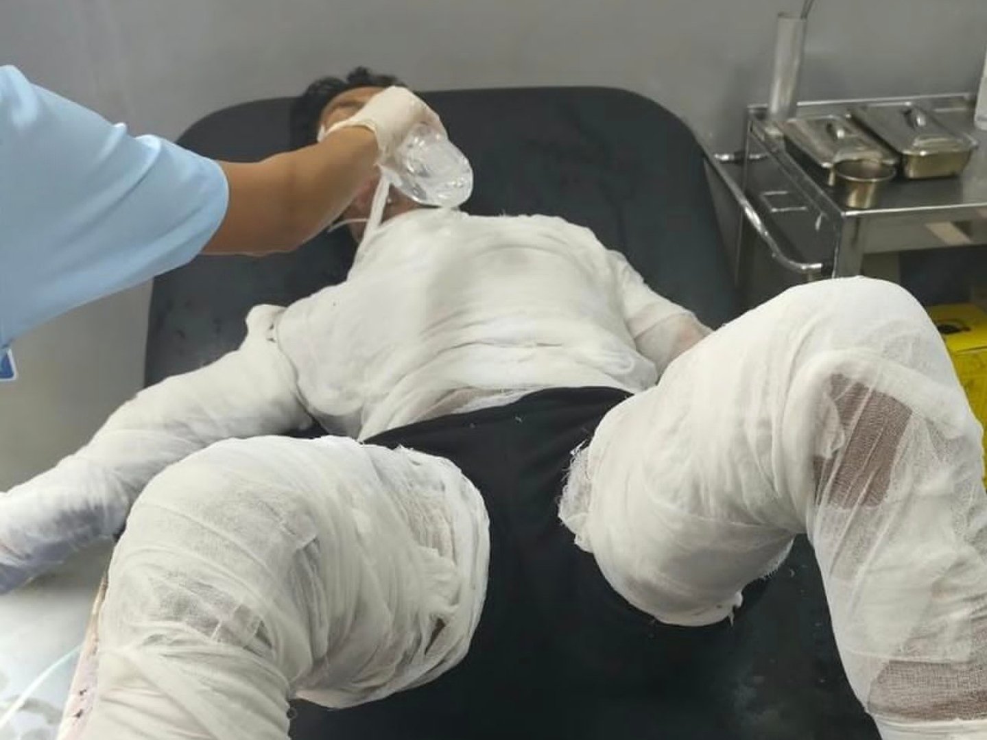 Perjuangan Selamet Melawan Luka Bakar 68 Persen Berakhir, Meninggal di RSUP Ngoerah